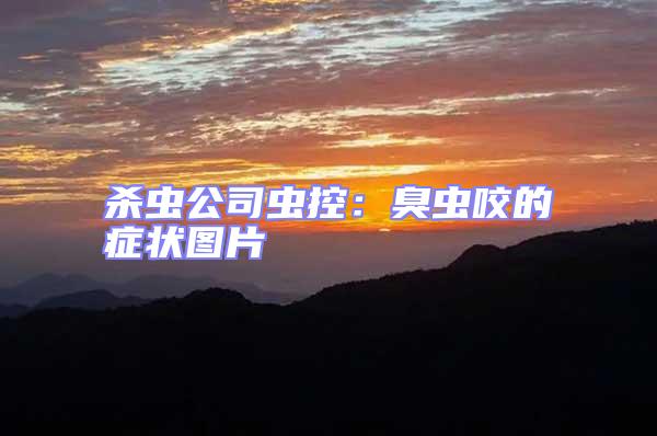 殺蟲公司蟲控:臭蟲咬的癥狀圖片