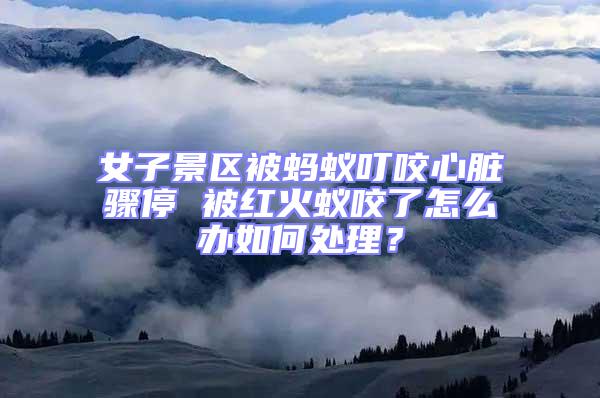 女子景區被螞蟻叮咬心臟驟停 被紅火蟻咬了怎么辦如何處理?